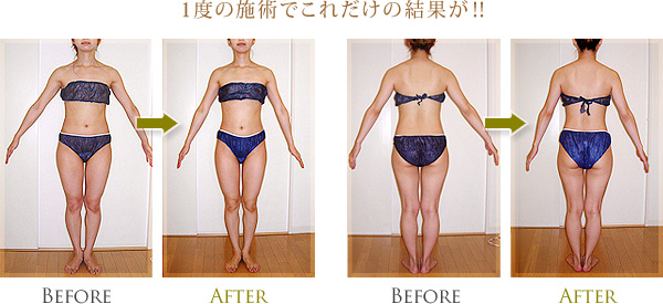 �����e�Z���s�[�Ǘ�ʐ^